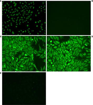 Human VH4-34 antibodies derived from B1 cells are more frequently autoreactive than VH4-34 antibodies derived from memory cells